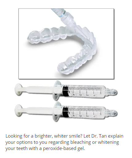 Take home teeth whitening trays from Spring Complete Care Dentistry